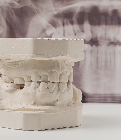 A close-up of a porcelain denture model on a table