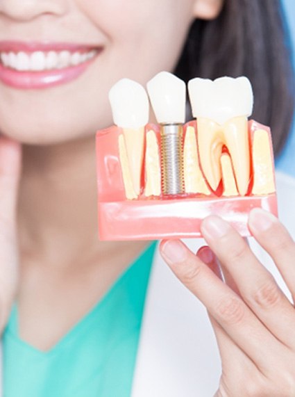 A dentist holding an enlarged model of a dental implant