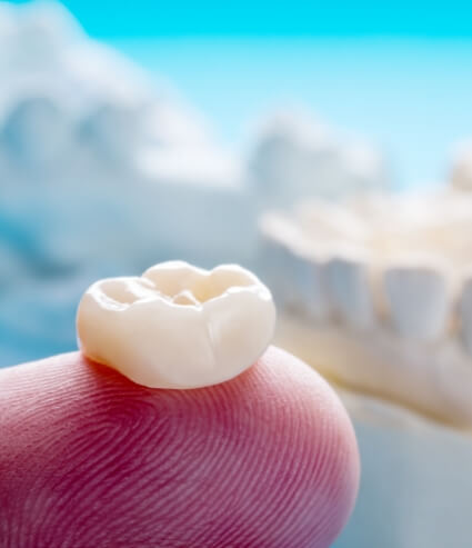 Close up of a dental crown on a person's finger