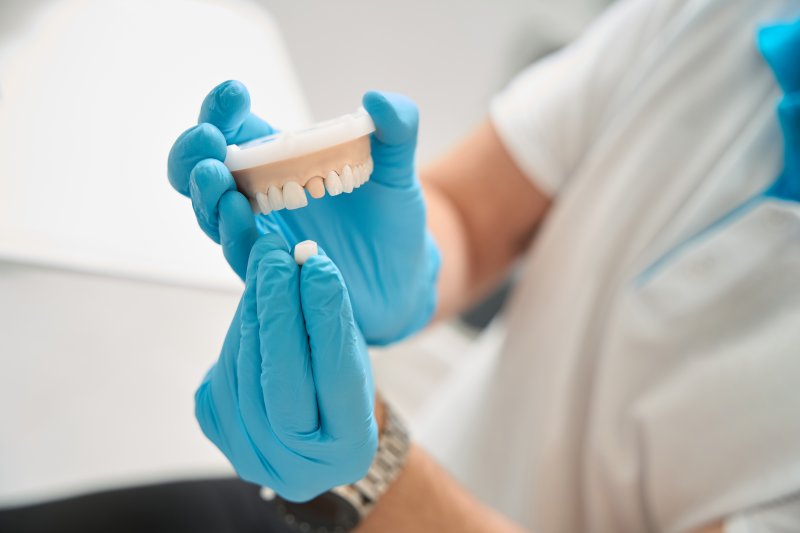 dentist holding mouth mold and dental crown